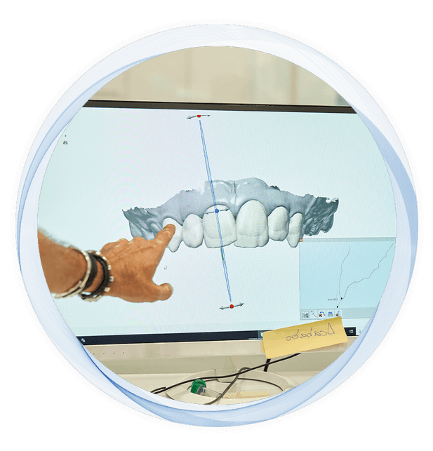 doctor pointing at the screen displaying teeth structure