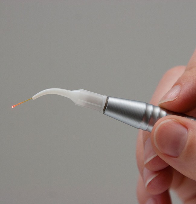 lanap laser periodontics